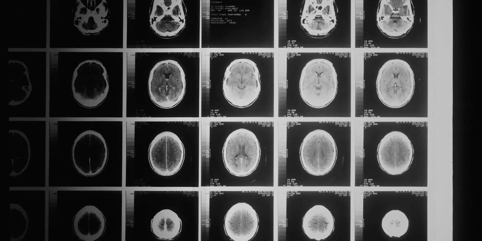 Neurologist reviewing scans in clinical consultation